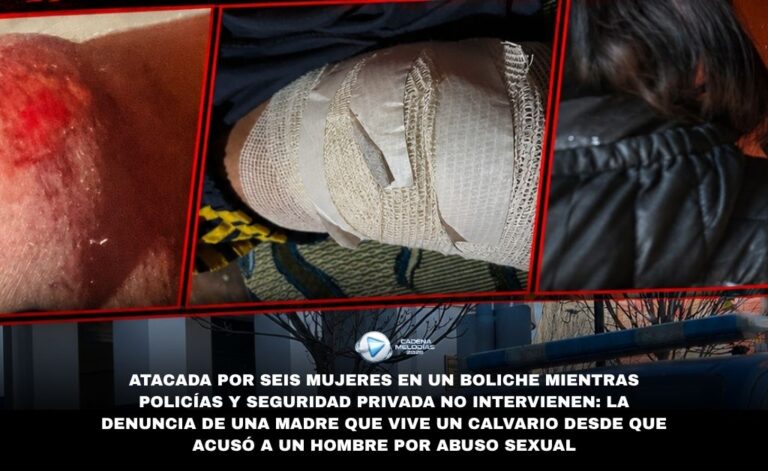 Violencia en Laboulaye: Madre de dos hijos fue brutalmente atacada por una patota de seis mujeres mientras policías y seguridad privada miraban sin intervenir